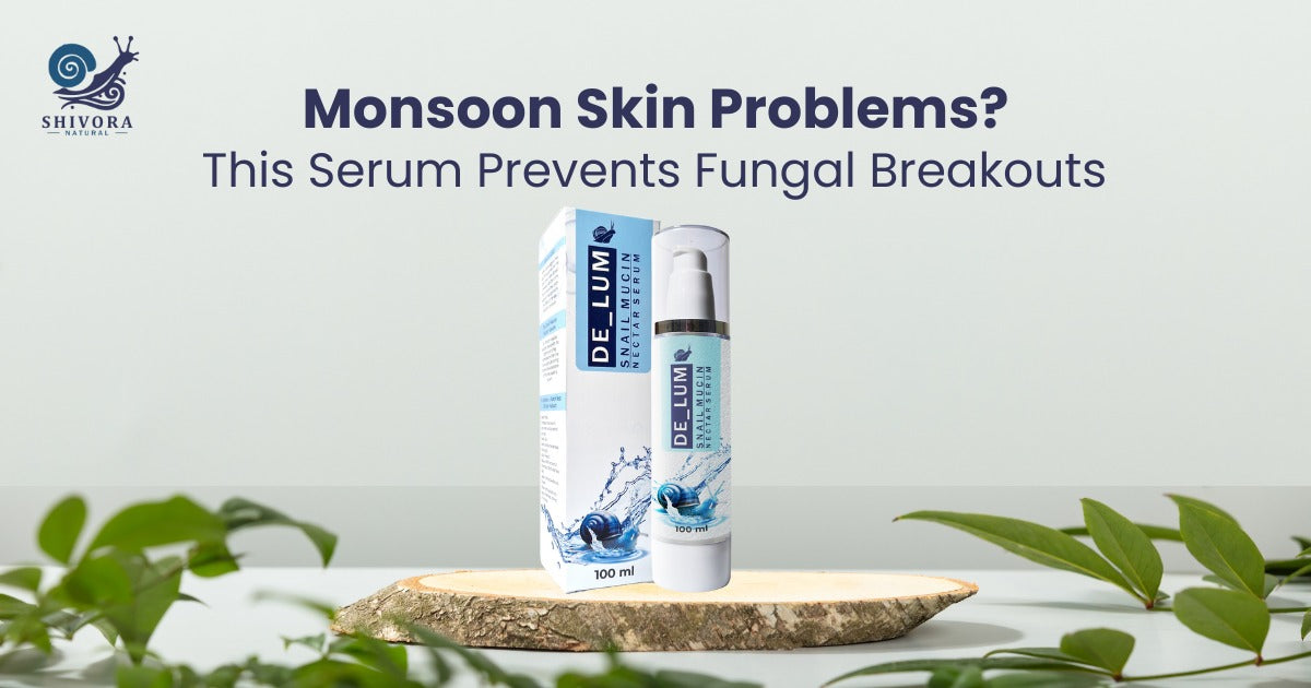 Monsoon Skin Problems? This Serum Prevents Fungal Breakouts Naturally